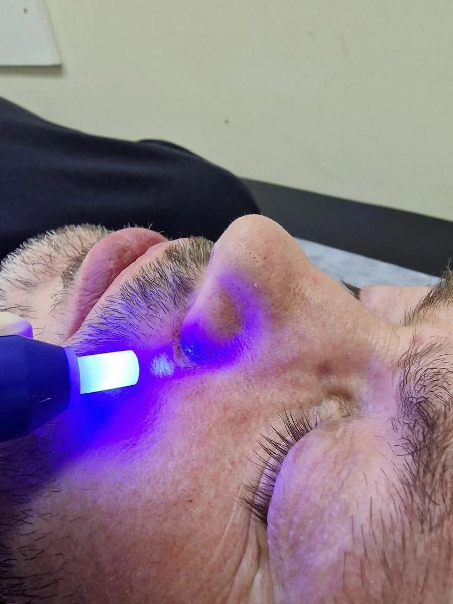 Лечение оксидом азота Лечение оксидом азота