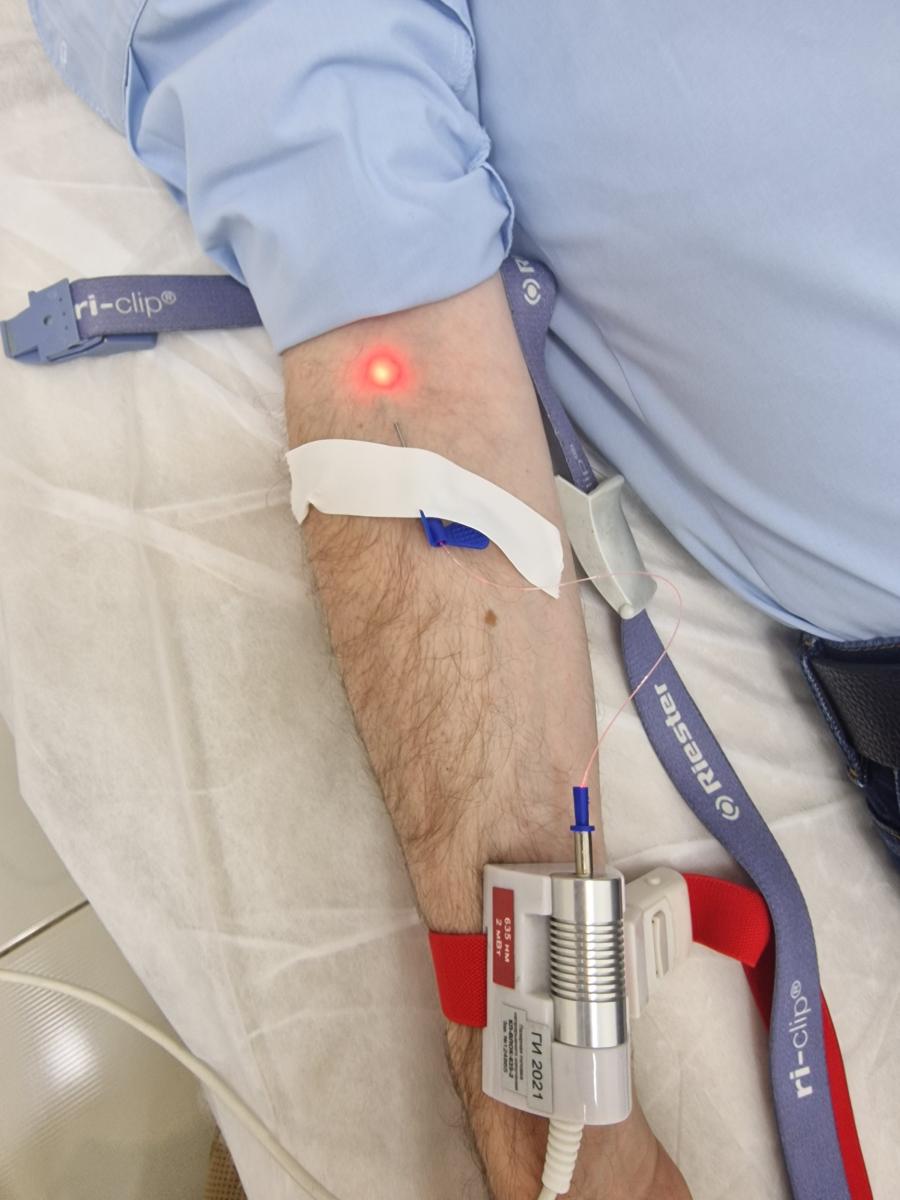 УФ облучение крови уфо крови