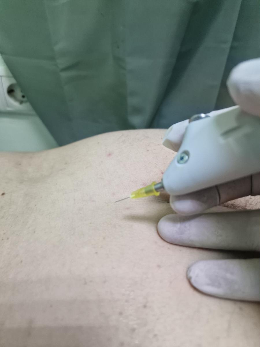 заражение через шприц заражение врача сифилисом