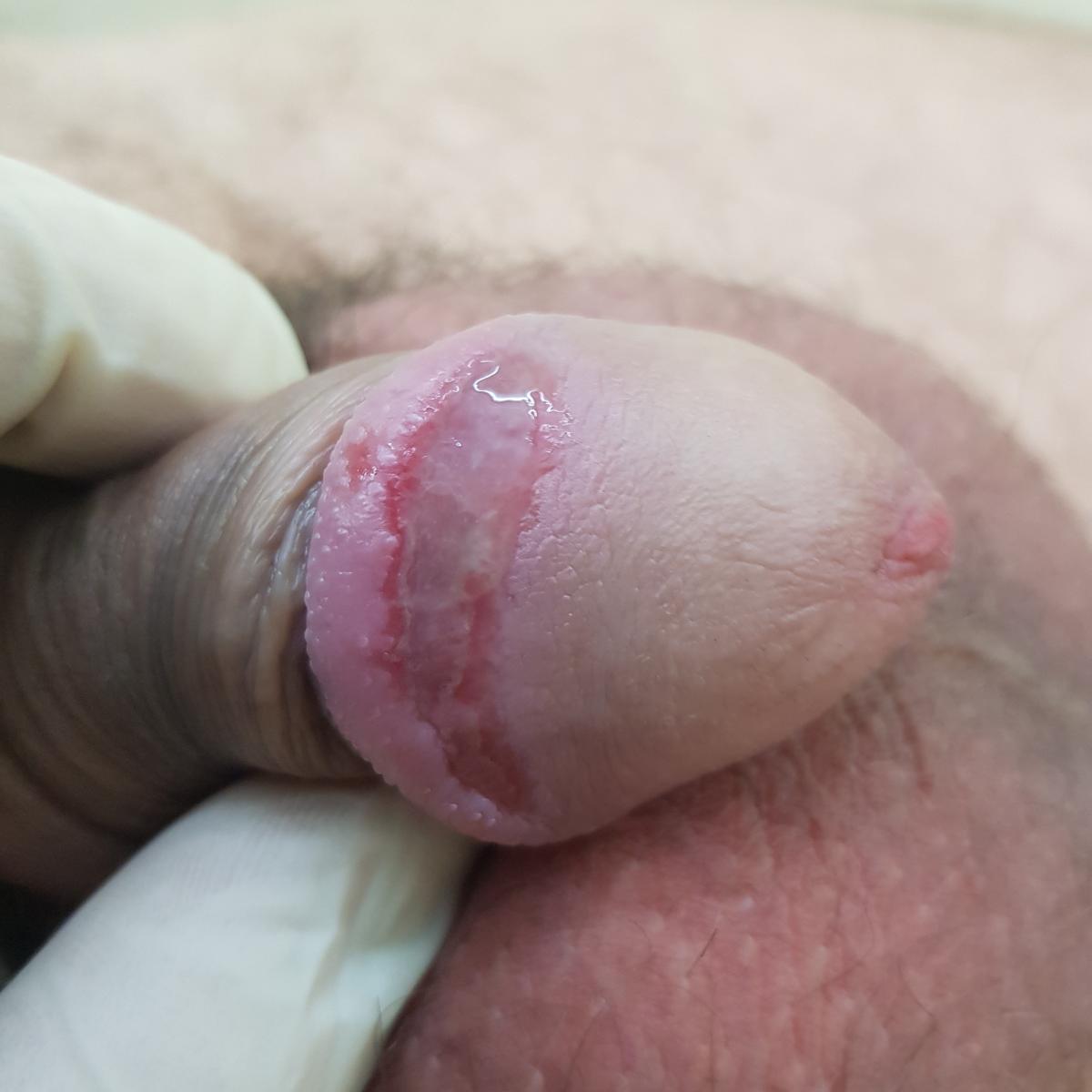 укус на члене укус на члене