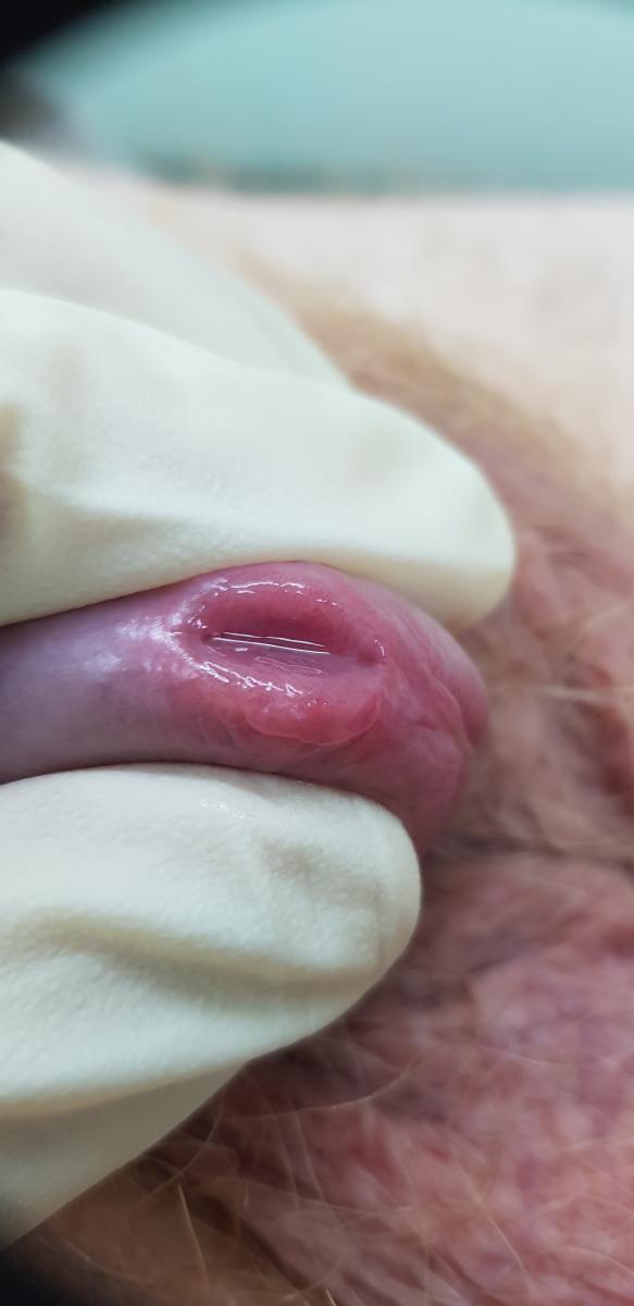 комплекс анализов на ИППП при выделениях у мужчин