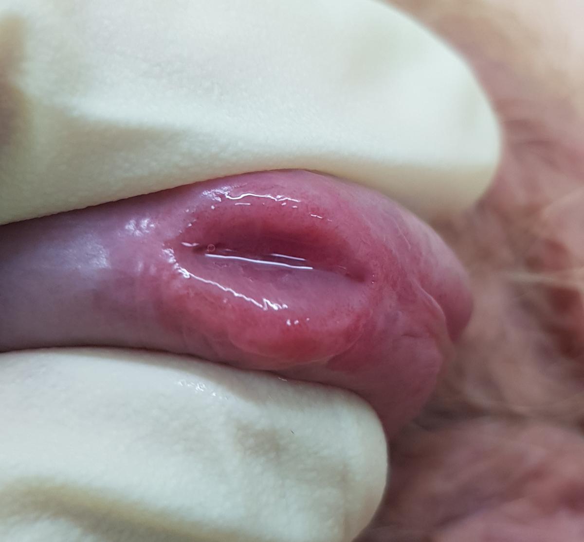 бактерия микоплазма микоплазма хоминис