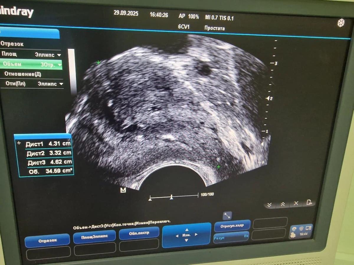 Узи пациента