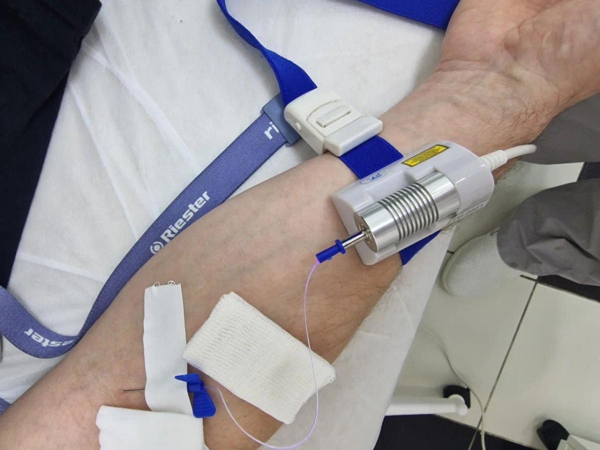 Облучение крови