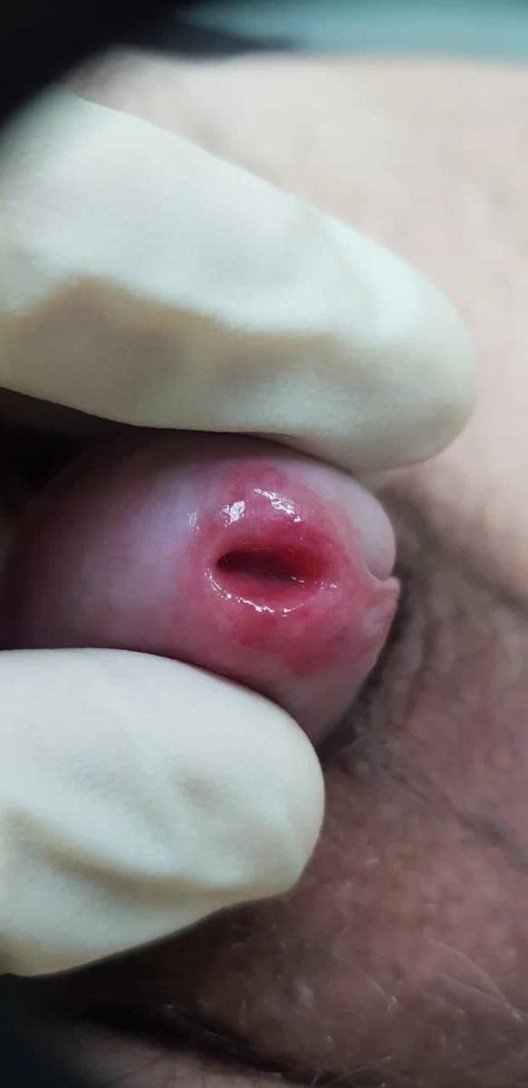 воспаление воспаление