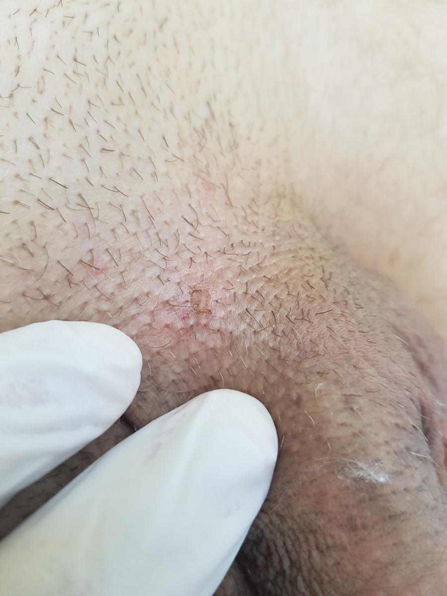 после удаления пример 1 после