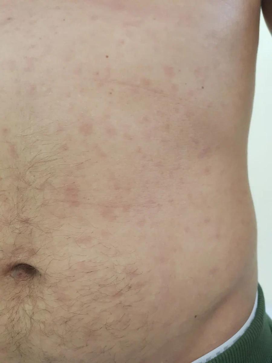 исследования с целью увеличения достоверности диагностики