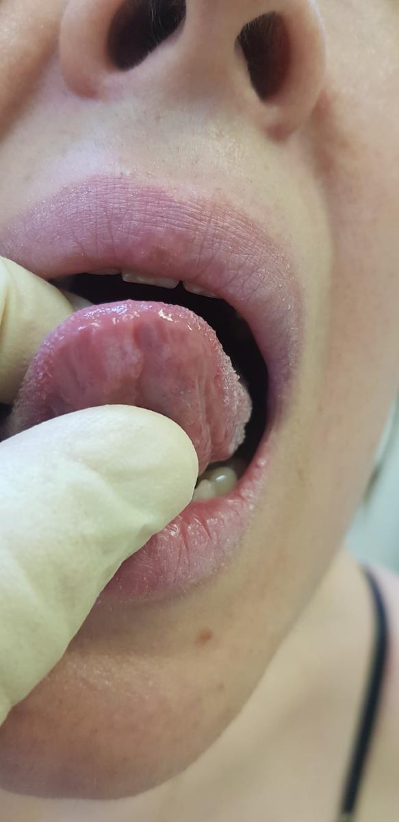 антитела в крови