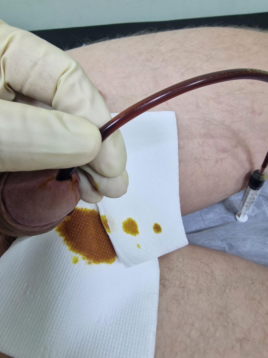 инстилляция