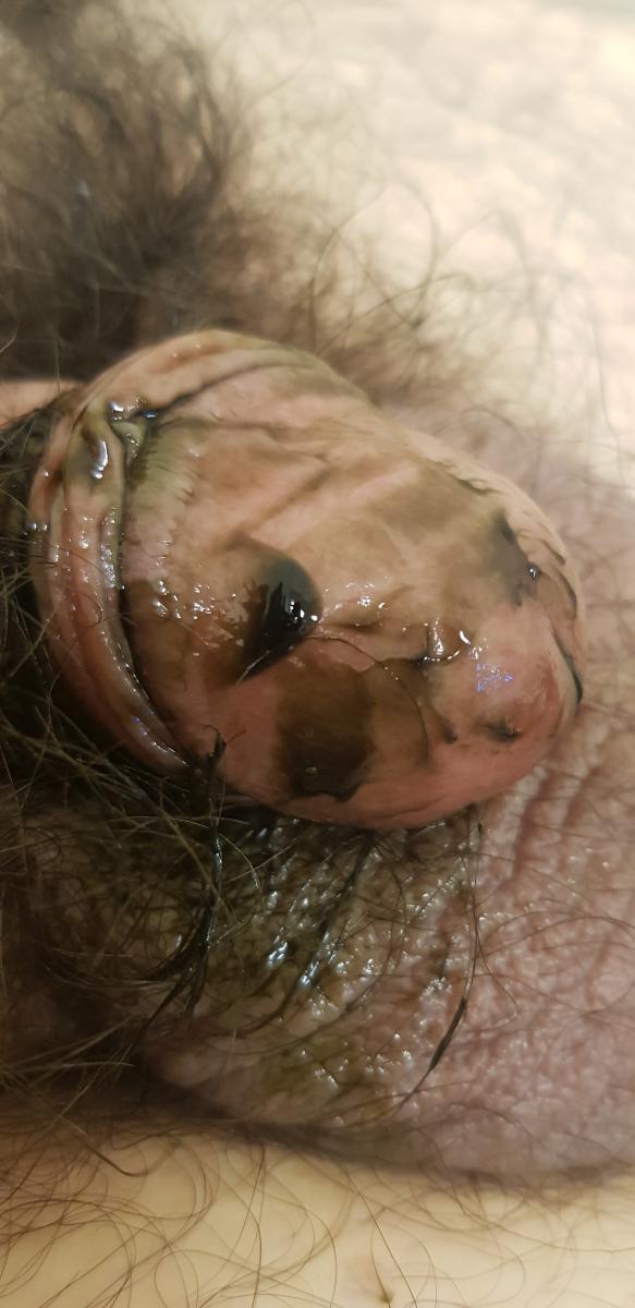 фотодинамика