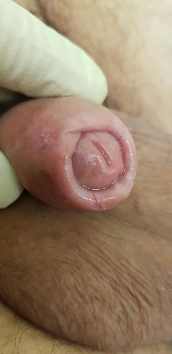 после 1й фтд