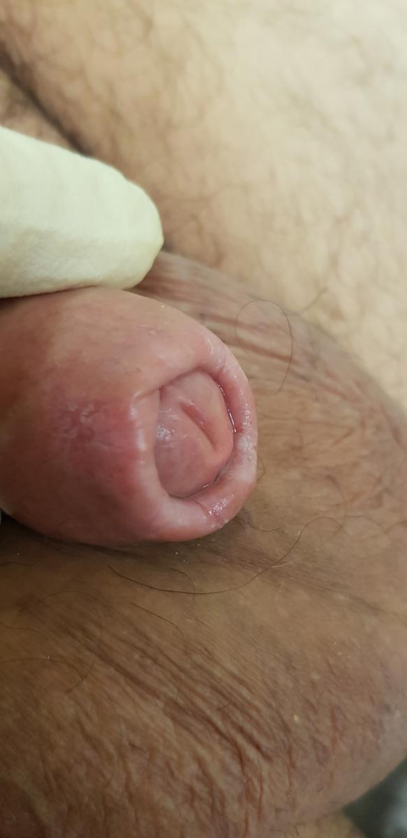 после первого сеанса 