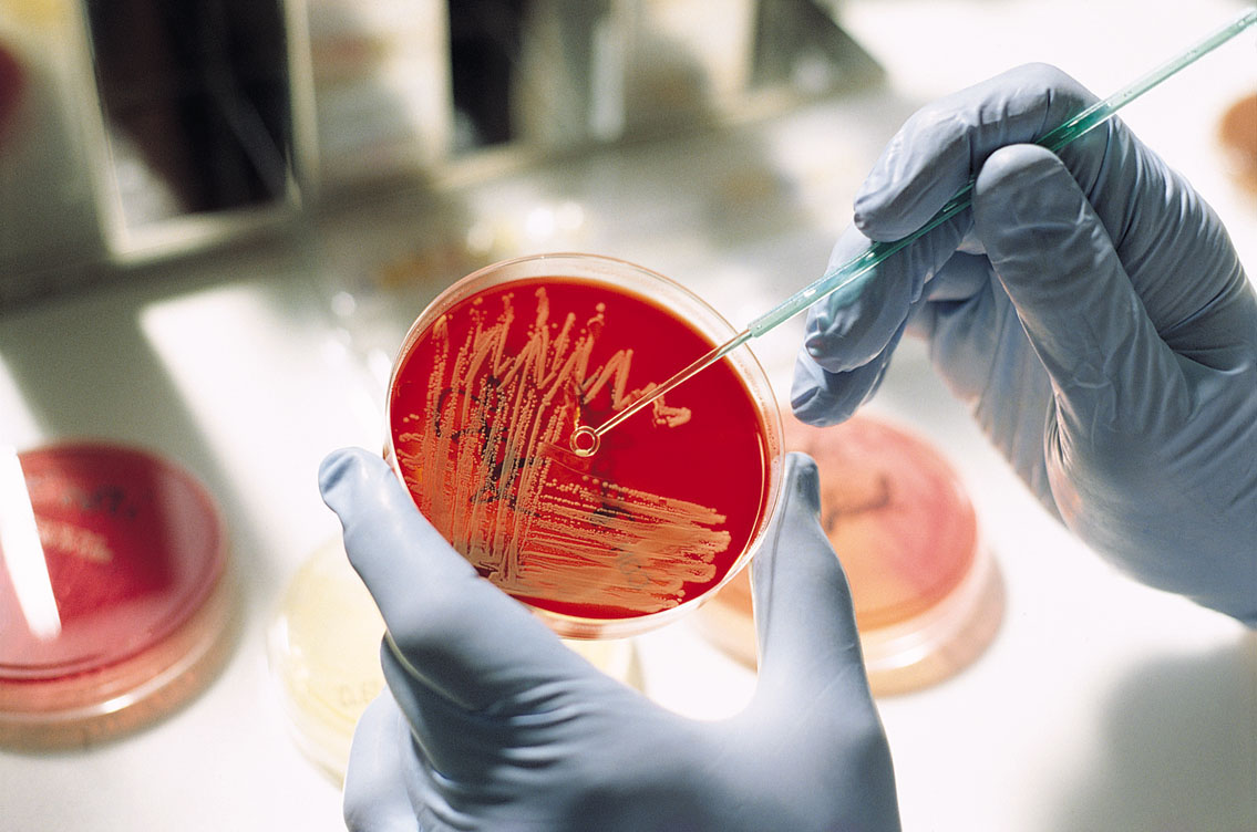 Бактериологический посев – чувствительность микроорганизма к разным антибиотикам