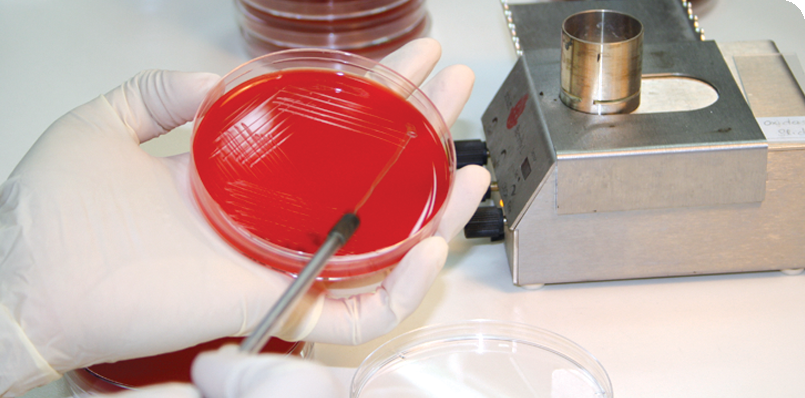 Исследования на бактерии и вирусы проводится методом бактериологического анализа