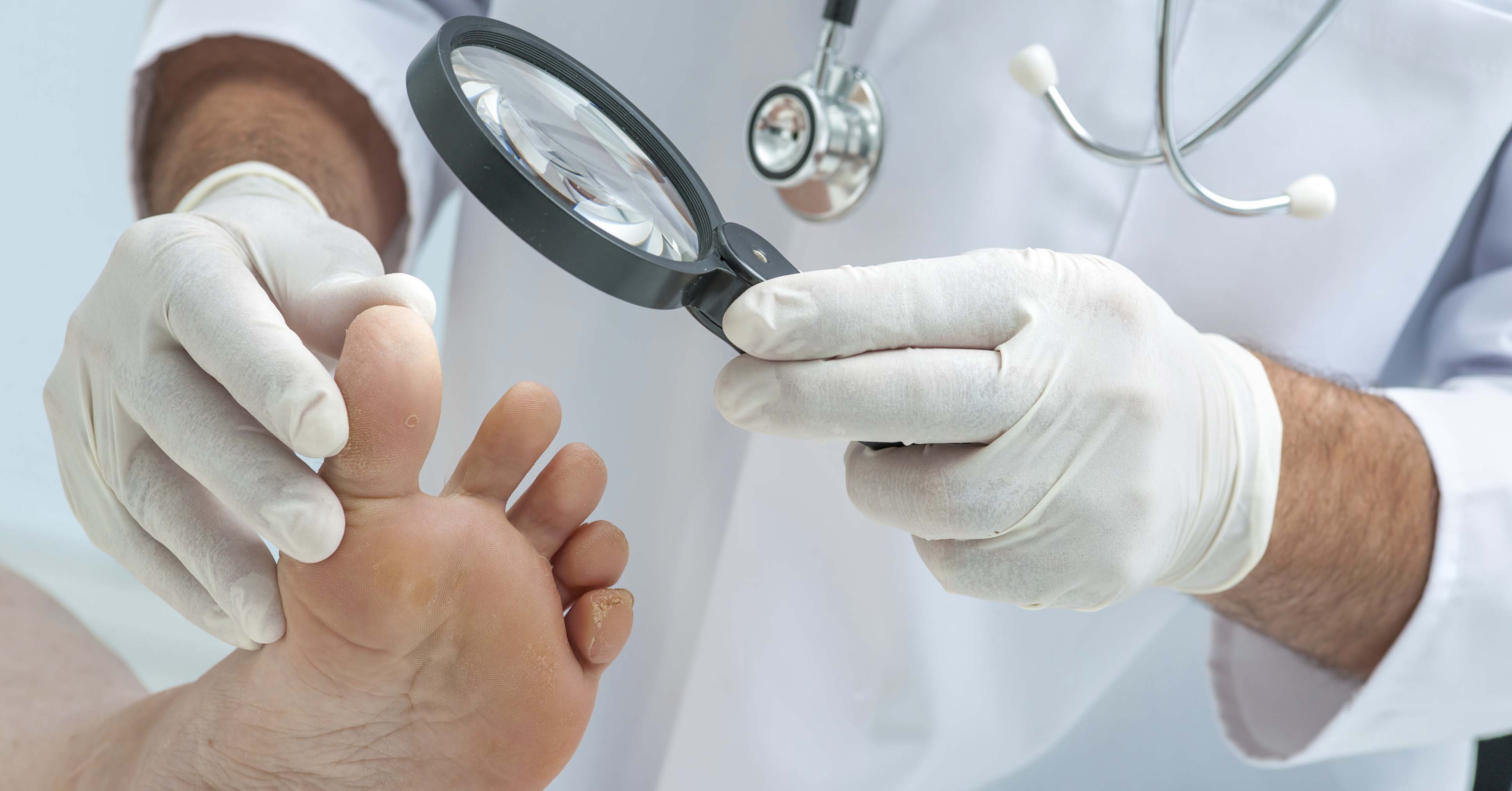  осмотр врача дерматолога-венеролога при болезнях ногтей