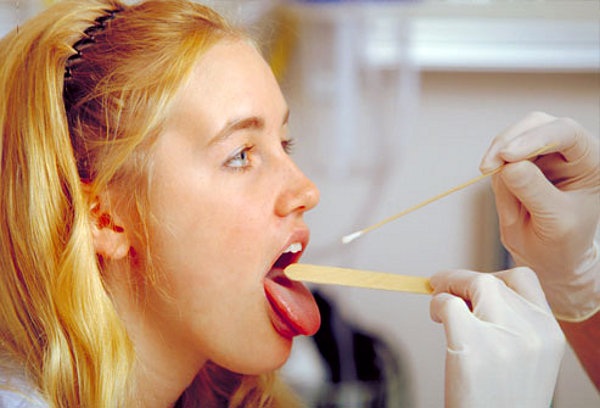  венерологические анализы изо рта