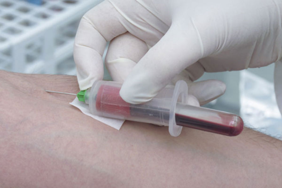  анализы крови на консультации венеролога