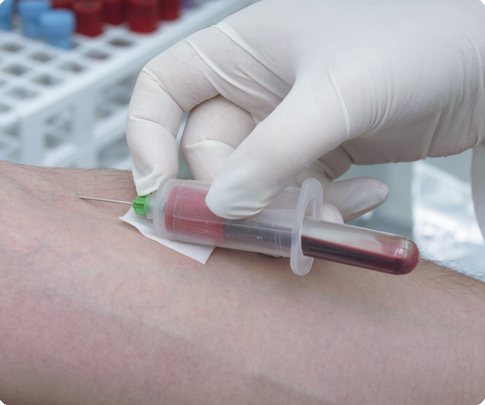 ИФА анализ крови на инфекции