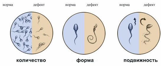 Оценка строения сперматозоидов