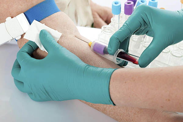  анализ крови на антитела к возбудителям венерических инфекций