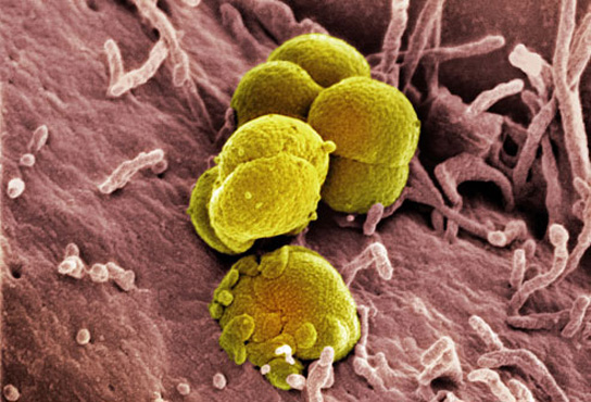 Возбудитель гонореи – патогенная бактерия Нейссера, или гонококк