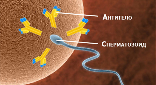 Наличие антител к собственным сперматозоидам