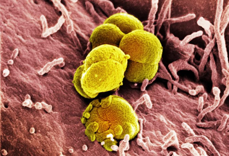 бактерии - Причины баланопостита