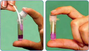 методика полимеразной цепной реакции (ПЦР) позволяет определить наличие любого вида микоплазмы