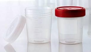 специальные стерильные стаканчики для сбора биологических жидкостей.